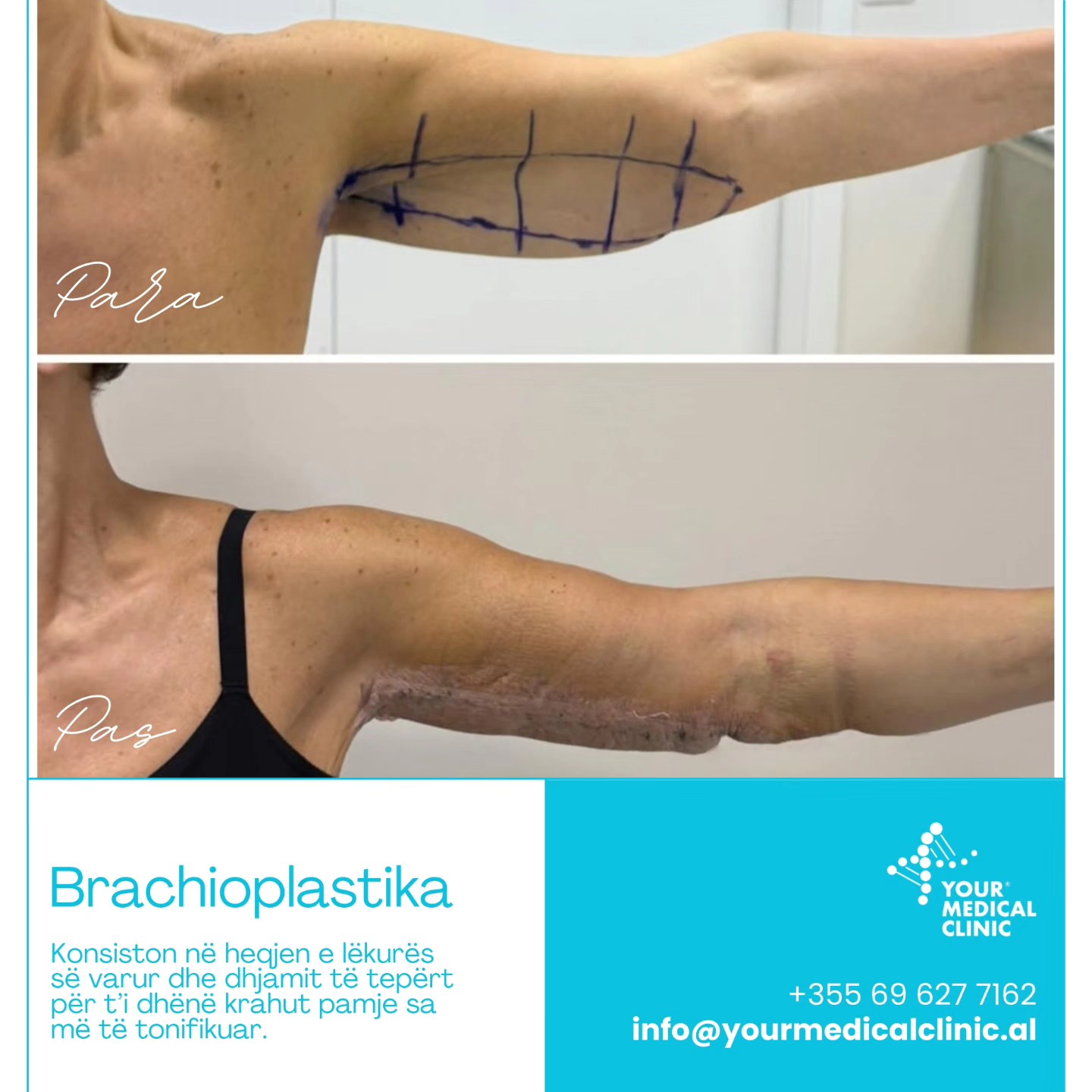 600269089_854630530866321_1330472877793963894_n